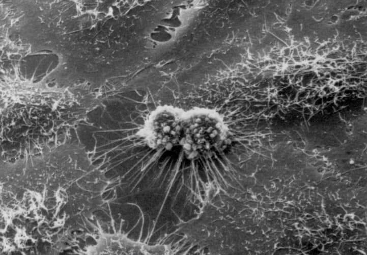 Клетки HeLa под микроскопом &mdash; первая бессмертная клеточная линия человека