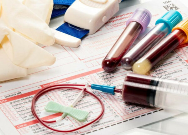 Что показывает коагулограмма: развёрнутый анализ ключевых параметров гемостаза