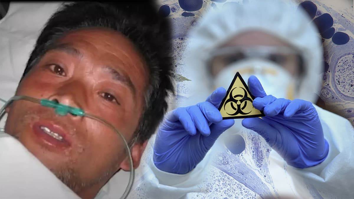 Хисаши Оучи — японский техник, получивший рекордную дозу радиации в аварии на заводе JCO в Токаймуре в 1999 году