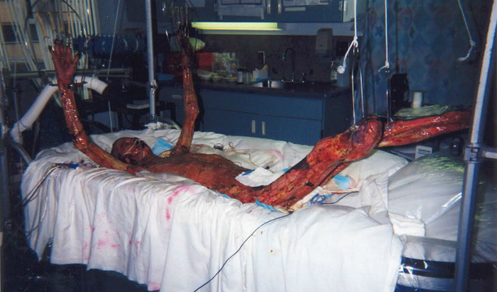 Предположительный снимок из больницы периода лечения Хисаши Оучи — подлинность фотографии не подтверждена