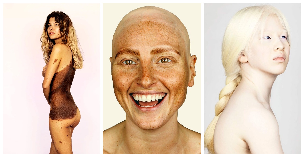 Bigpicture ru коллаж