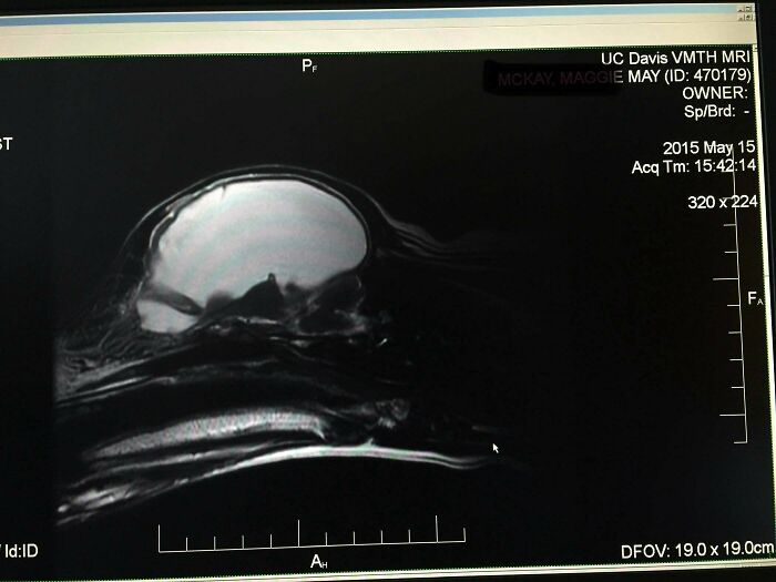 МРТ собаки с гидроцефалией: 95% черепа заполнено жидкостью вместо мозга