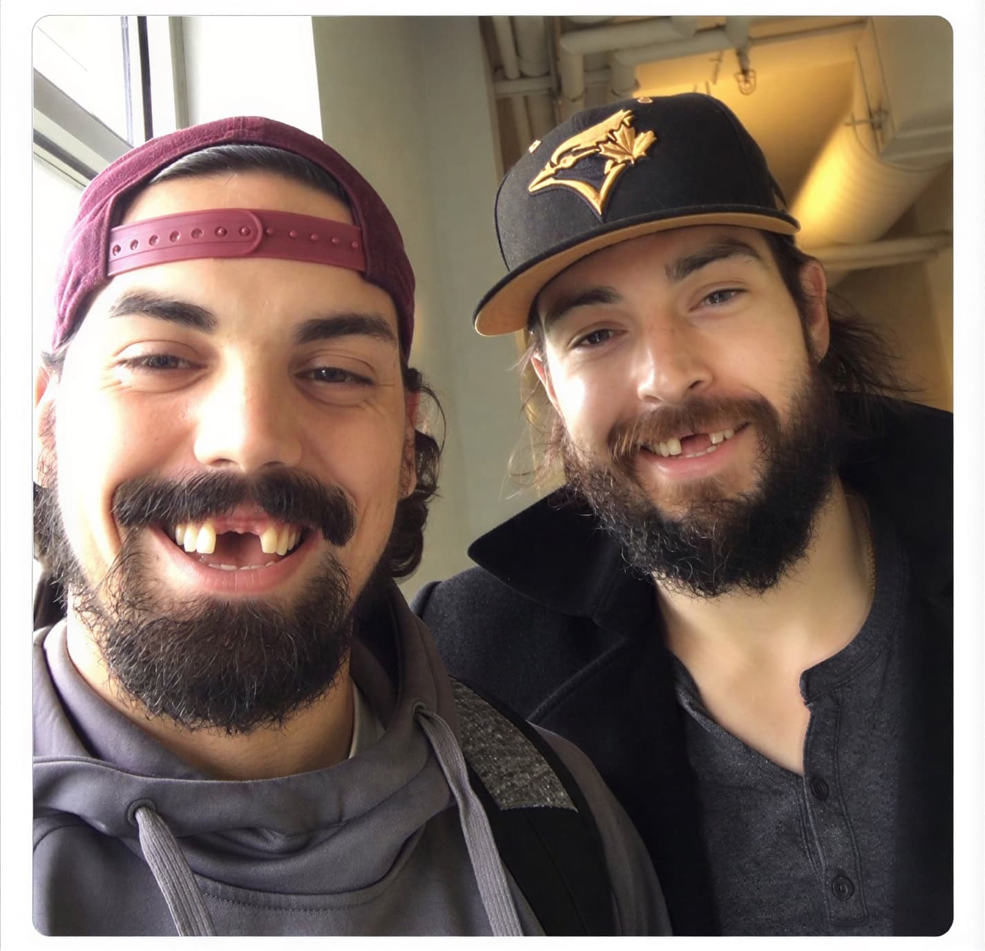 Два бородатых парня в кепках с выбитыми зубами широко улыбаются вместе