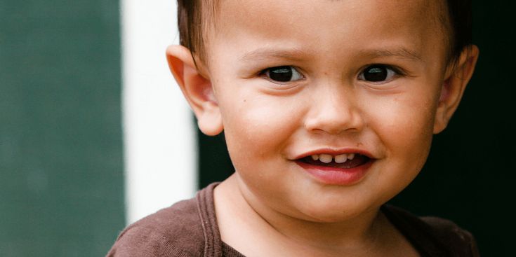 Мозаичная форма синдрома Дауна