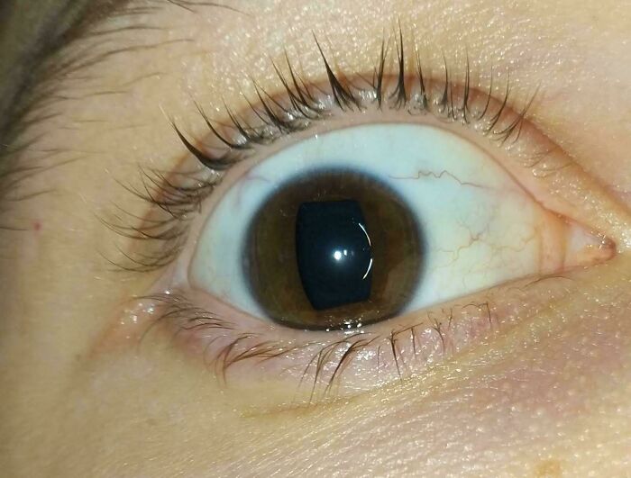 Человеческий глаз с прямоугольным зрачком