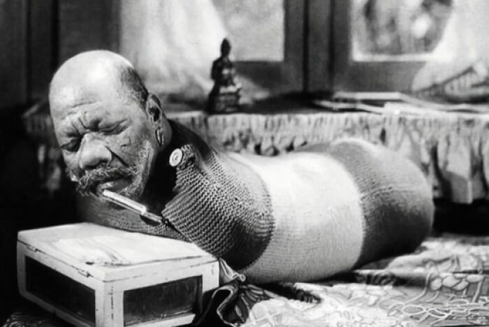 Принс Рэндиан — артист цирка с синдромом тетраамелии, выступавший у Барнума