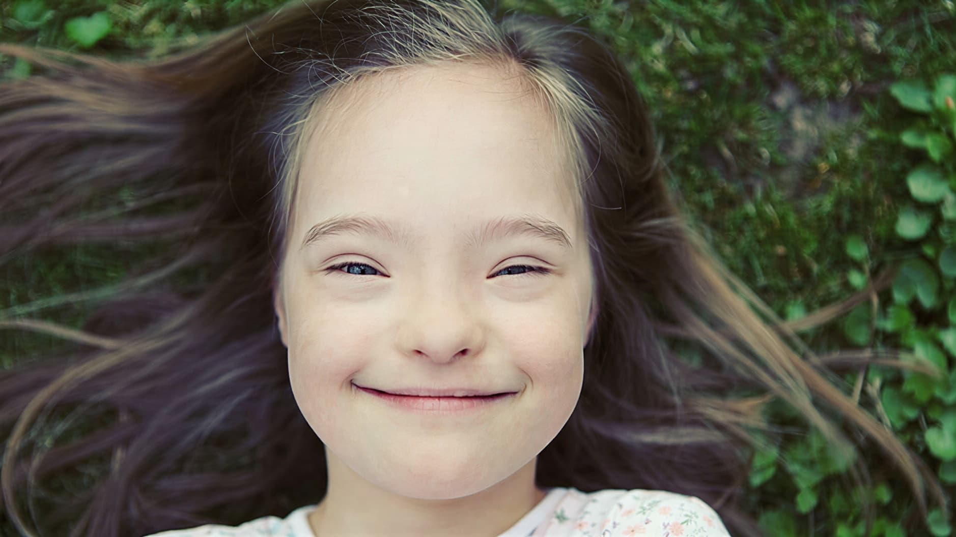 Почему люди с синдромом Дауна похожи друг на друга: объяснение генетики