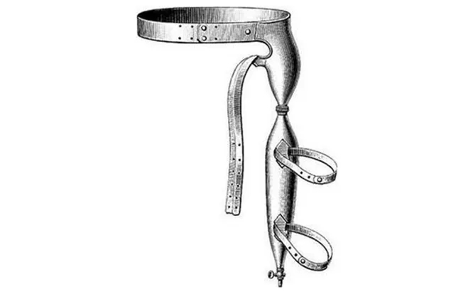 Сперматический бандаж Стивенсона, 1876 год, антимастурбационное устройство