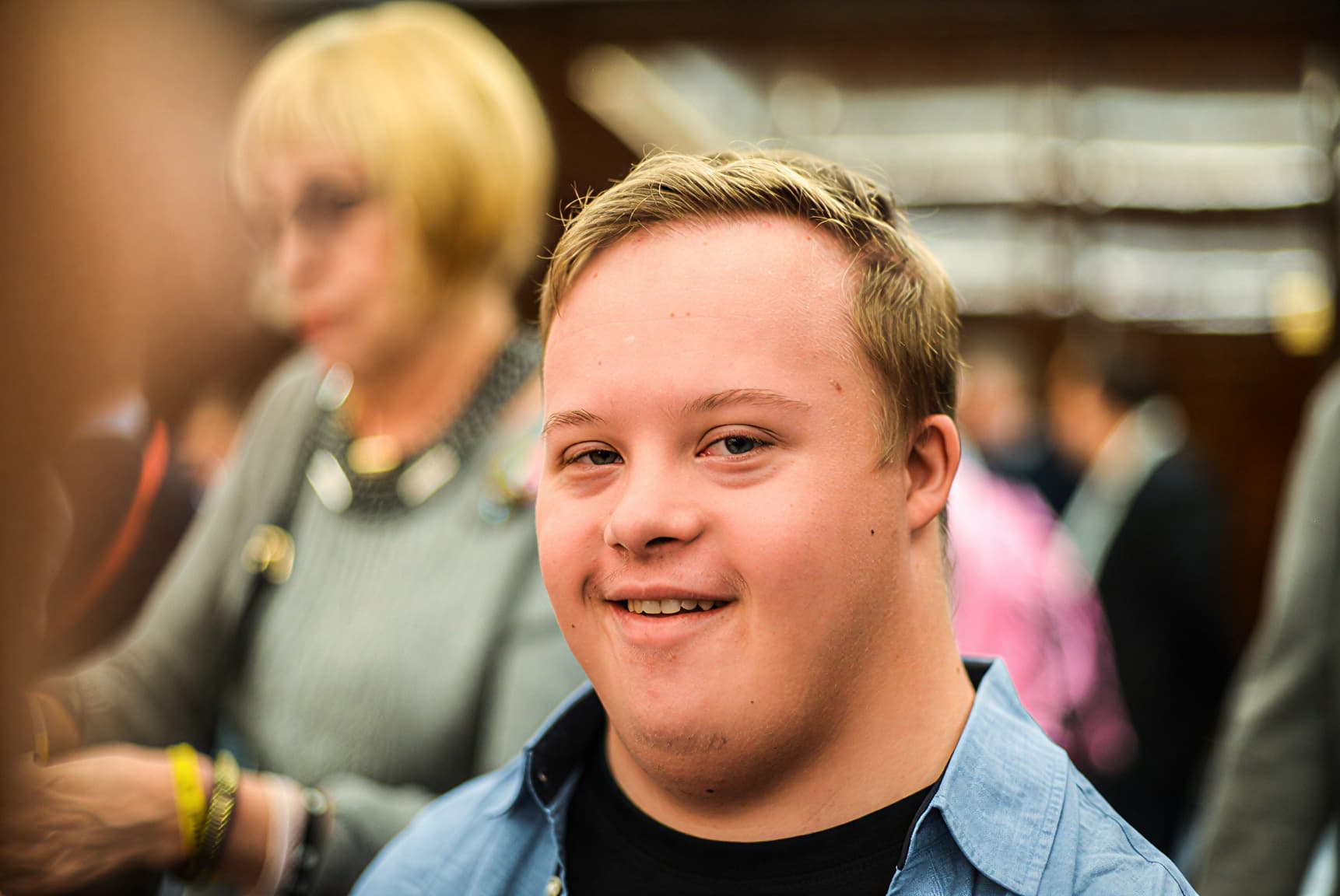 Лицо человека с синдромом Дауна крупным планом