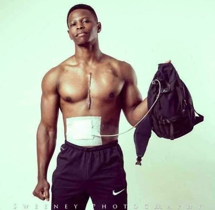 Эндрю Джонс, фитнес-модель с искусственным сердцем в рюкзаке, на соревнованиях по бодибилдингу