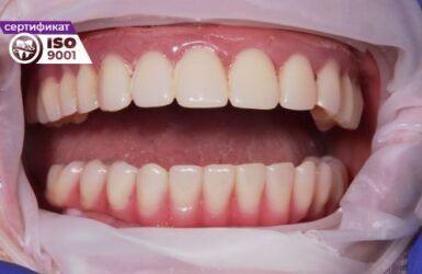 Bigpicture ru primer av 23 i2 posle 385x250