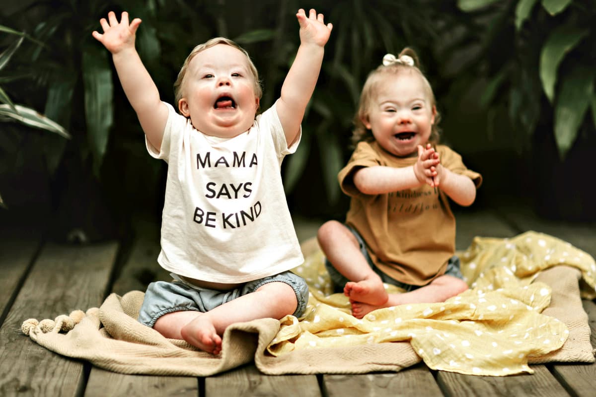 Дети с синдромом Дауна характерные черты лица