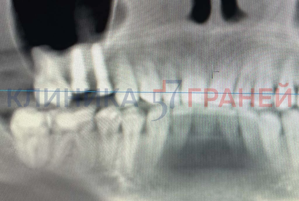 Ck3jxy93ap60fcbq9kecbjvr5g5ew56y