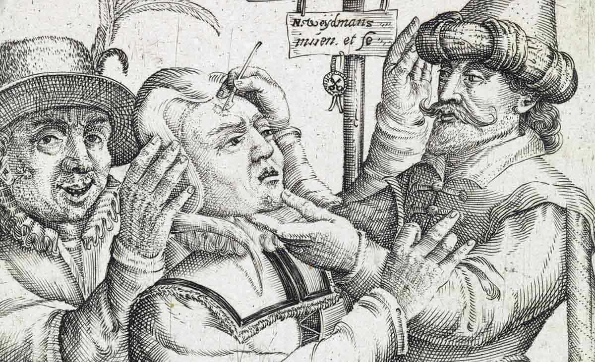 Гравюра: укол иглой при поиске дьявольской метки, Нидерланды, XVII век