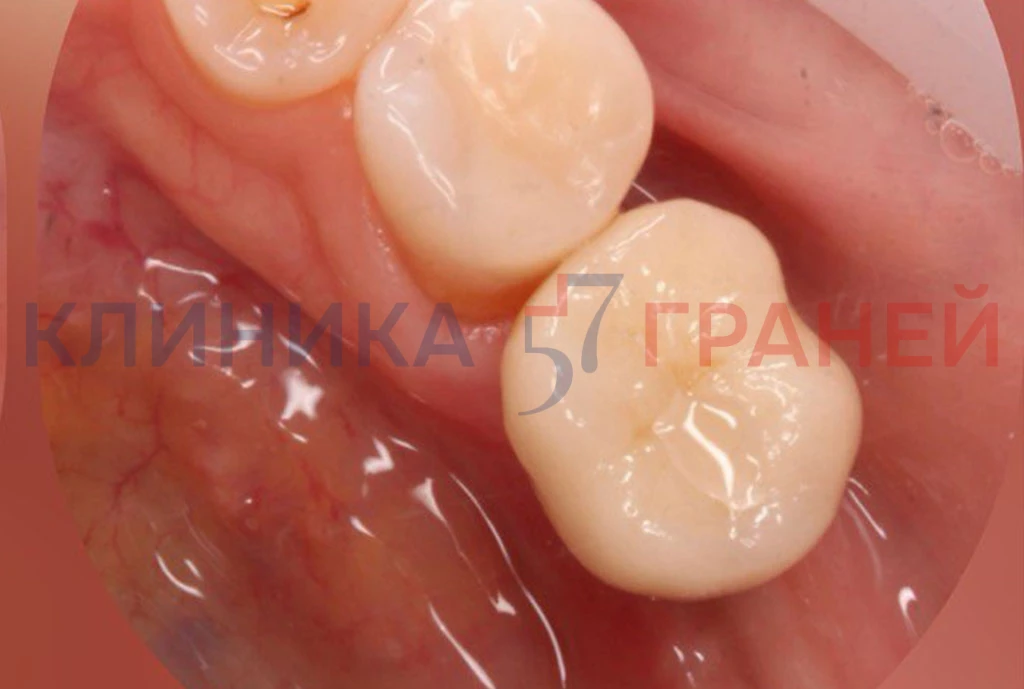 Qmuv3u9bovxm1wdy91hh9g17p2boc00x