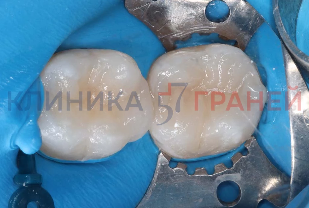 Xjm9uayk7uahtk6za9pf7tt0wlp0j1iy