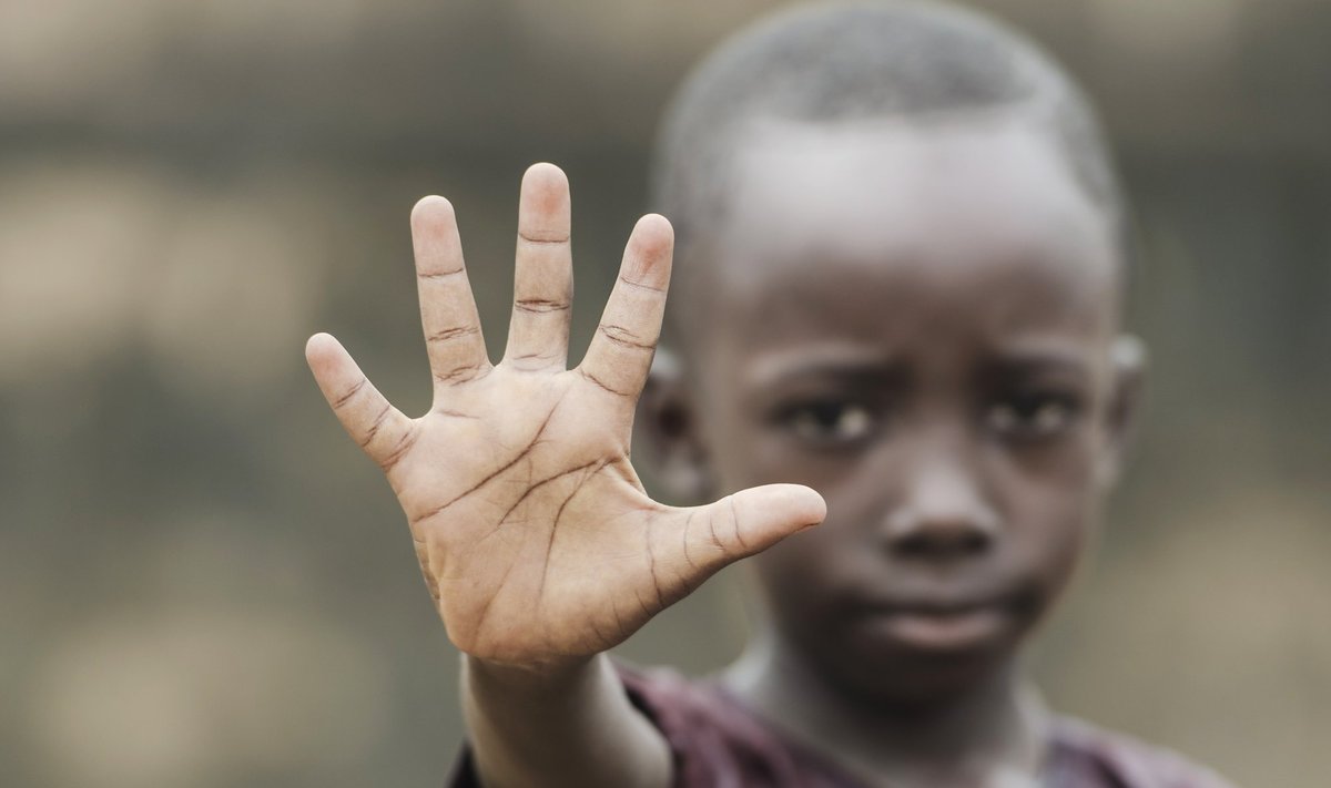 Ладони человека с тёмной кожей &mdash; яркий контраст между тыльной стороной кисти и светлой внутренней поверхностью