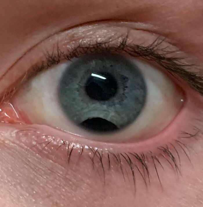 Голубой глаз человека с чётким зрачком