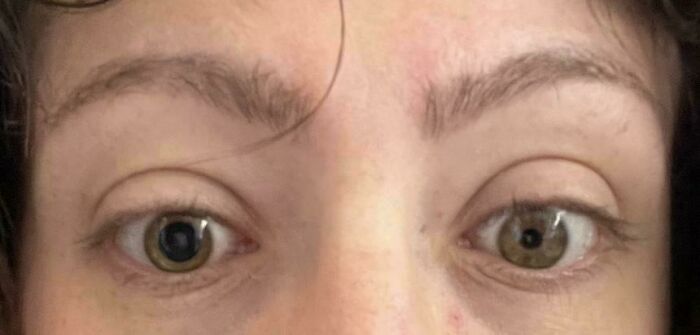 Женские глаза с разным размером зрачков крупным планом