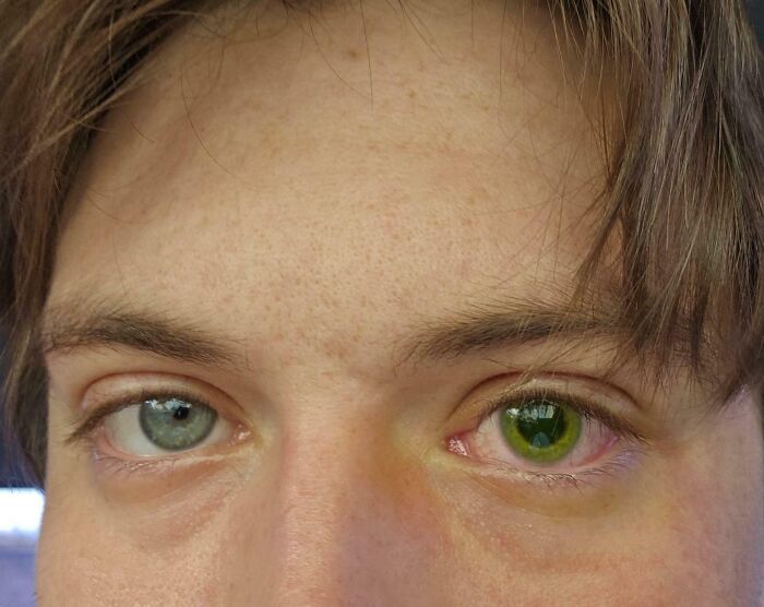 Мужские глаза с зелёным и серым цветом радужки