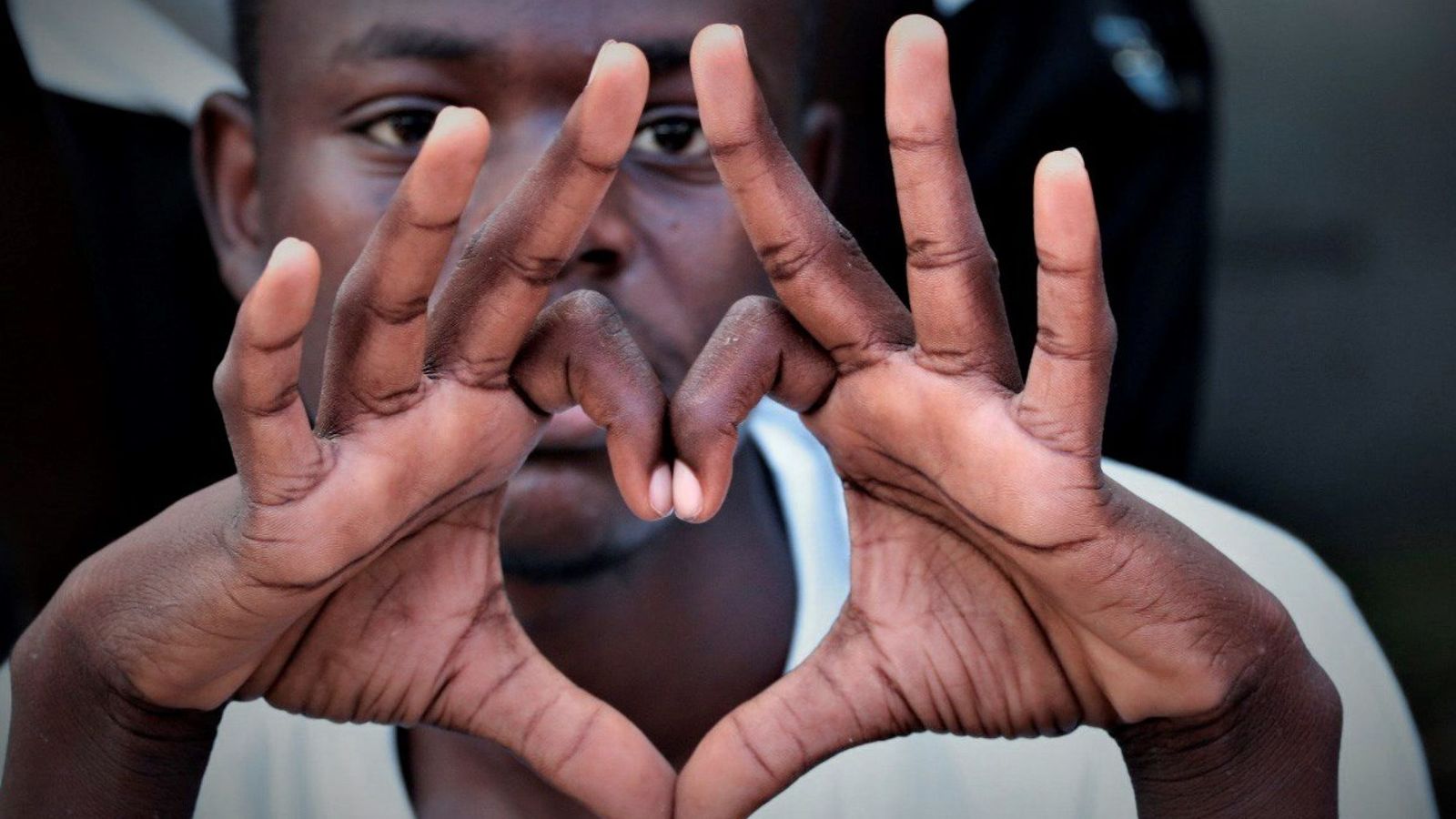 Руки человека с тёмной кожей &mdash; контраст между тыльной и ладонной поверхностью