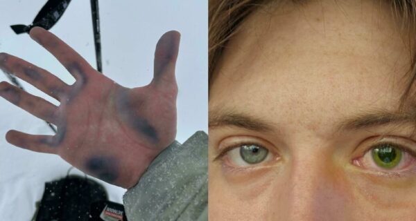 Тело человека: 22 фото состояний, которые трудно представить