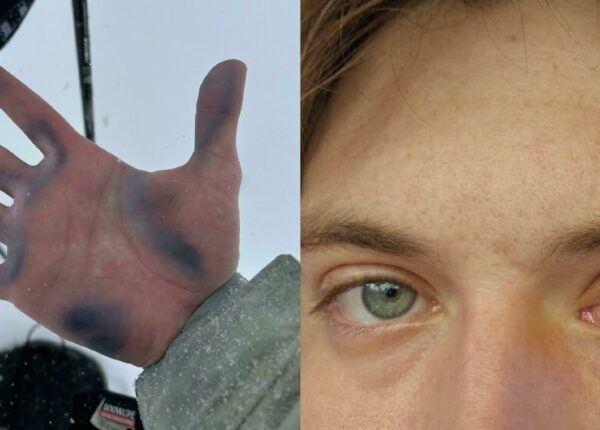 Тело человека: 22 фото состояний, которые трудно представить