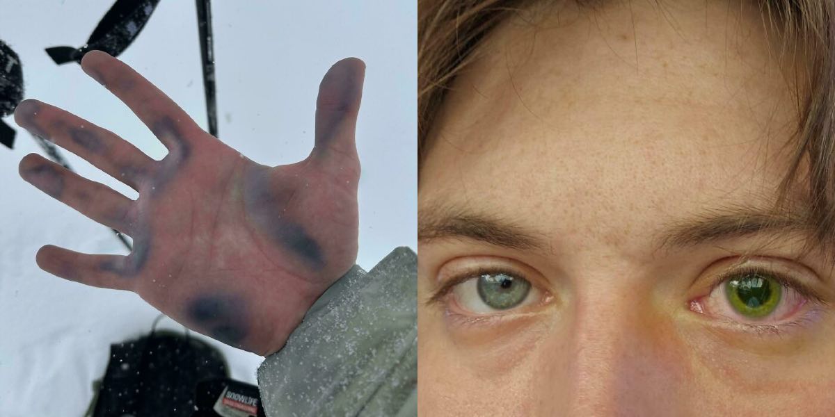 Human Body In Shapes And Conditions You Might Not Have Seen Before