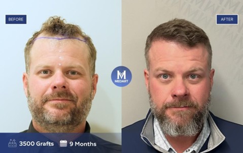 Bigpicture ru рисунок1