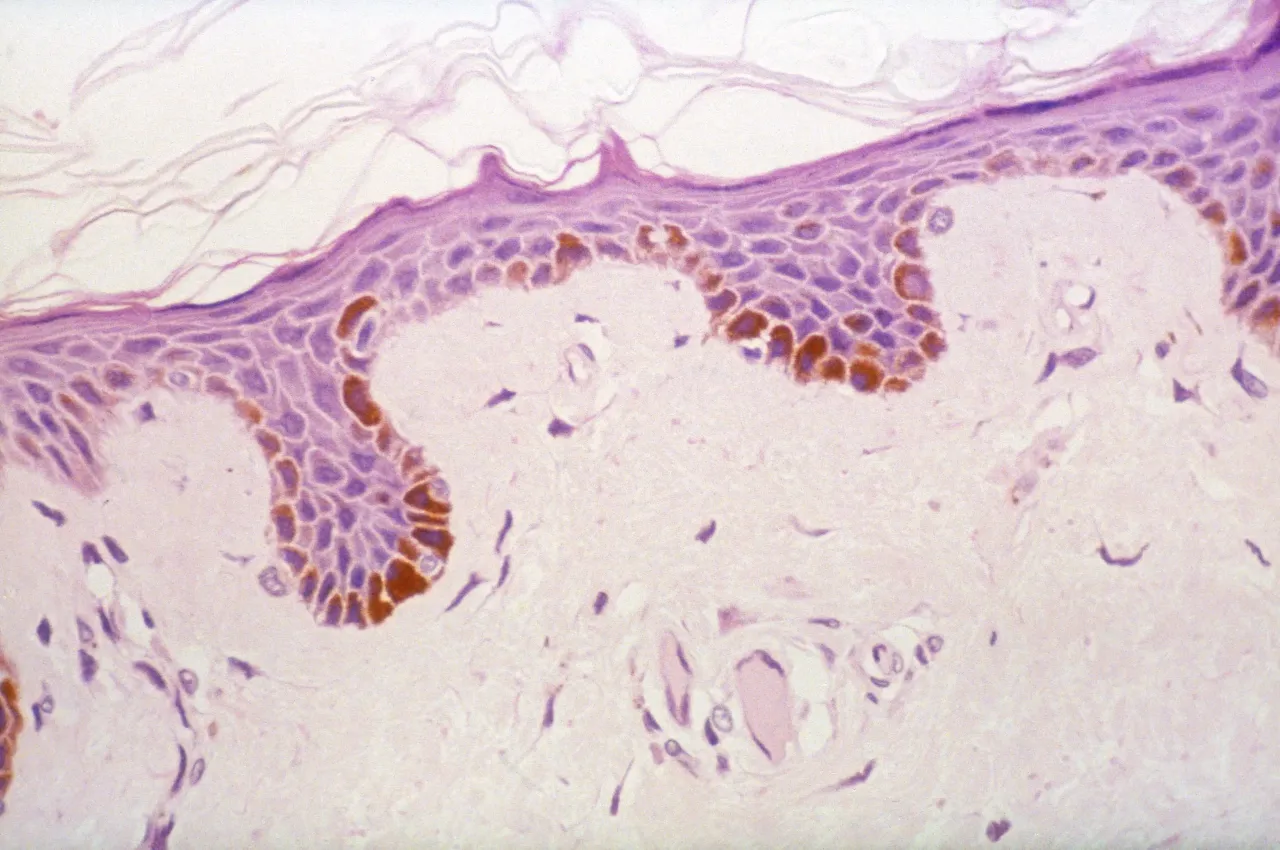 Микрофотография меланоцитов с длинными отростками