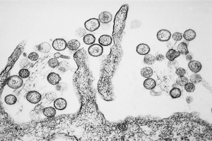 Возбудитель хантавирусной инфекции Orthohantavirus под электронным микроскопом