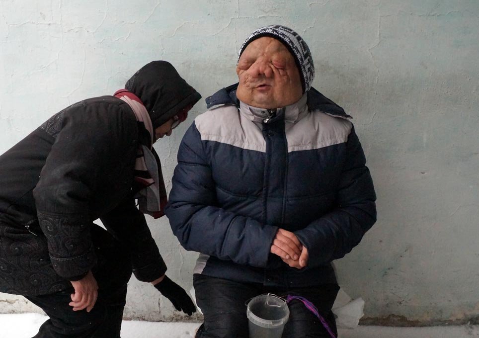 Жертва ядерного полигона.