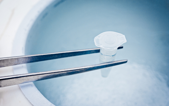 Test,tube,with,sperm,or,eggs,samples,,cryopreservation,in,the