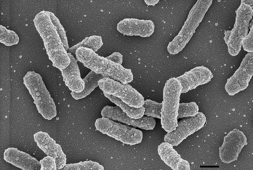 Чумная палочка Yersinia pestis под микроскопом